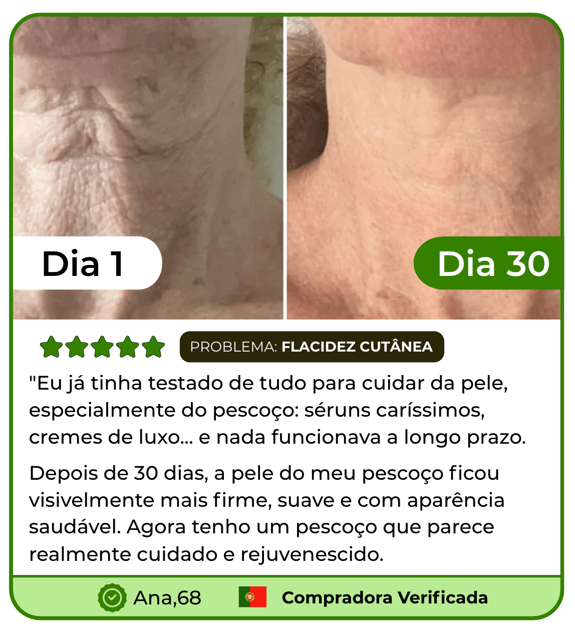 Massageador Facial para rosto e pescoço Efeito Lifting Anti-Rugas - LIFT SKIN™