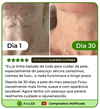 Massageador Facial para rosto e pescoço Efeito Lifting Anti-Rugas - LIFT SKIN™