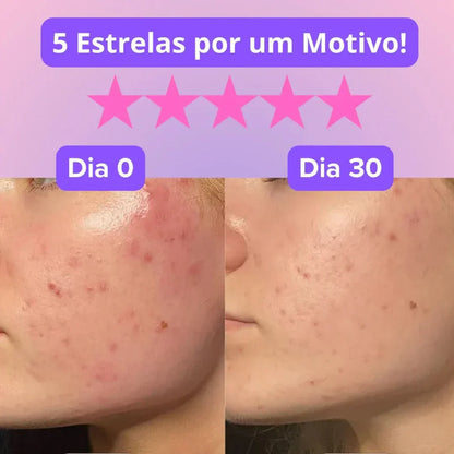 Máscara Rejuvenescedora efeito anti-rugas - LUMY™